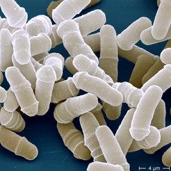 Rasterelektonenmikroskopieaufnahme von sich teilenden Spalthefezellen (Schizosaccharomyces pombe.
